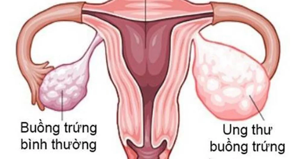 Tổng hợp các bệnh ở vùng kín nữ giới Tổng hợp các bệnh ở vùng kín nữ giới