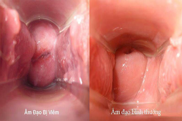 Tổng hợp các bệnh ở vùng kín nữ giới