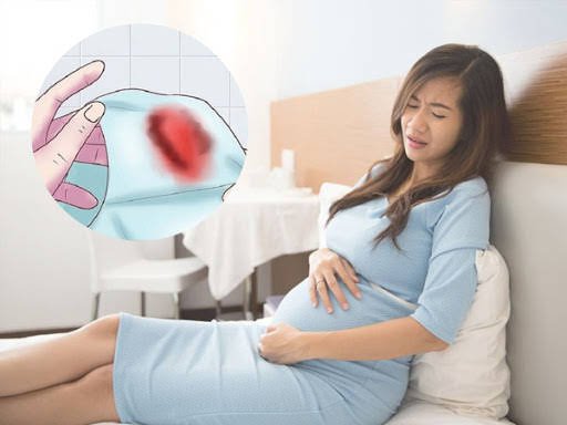 Chuyển dạ ra máu có ảnh hưởng đến thai nhi không? 9 Chuyển dạ ra máu có ảnh hưởng đến thai nhi không?