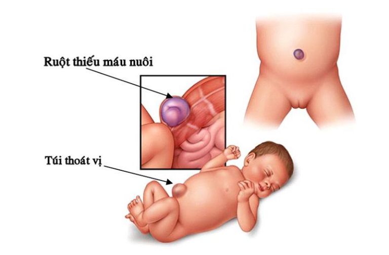 Top 7 dị tật thường gặp ở thai nhi cha mẹ cần lưu ý