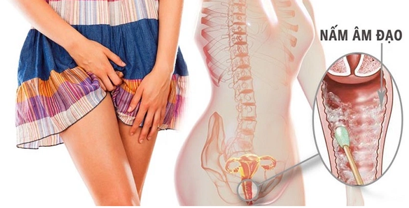 Đau rát vùng kín có phải dấu hiệu của bệnh ung thư