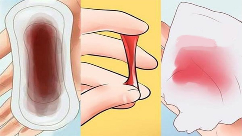 Ra máu và đau rát vùng kín: Phân biệt dấu hiệu bình thường và bất thường