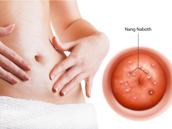 Bài Test Xác Định Nang Naboth Cổ Tử Cung: Làm Thế Nào Để Kiểm Tra Chính Xác? 5 Bài test xác định nang Naboth cổ tử cung