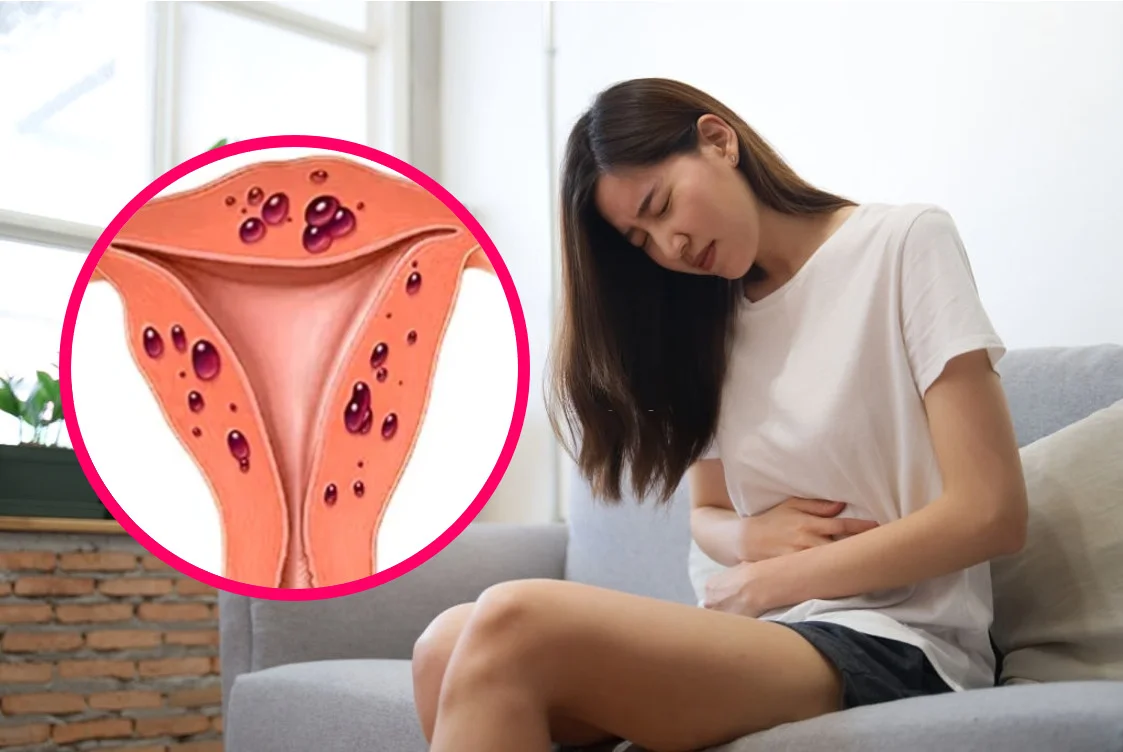 Top 5 bệnh phụ khoa thường gặp ở người chưa quan hệ 9 Top 5 bệnh phụ khoa thường gặp ở người chưa quan hệ
