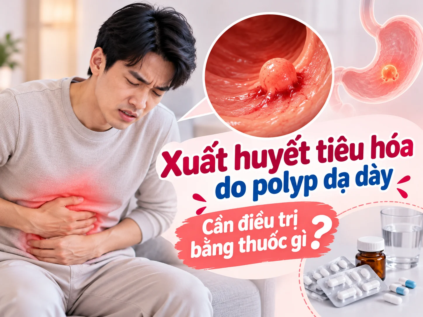 Xuất huyết tiêu hóa do polyp dạ dày: Cần điều trị bằng thuốc gì?