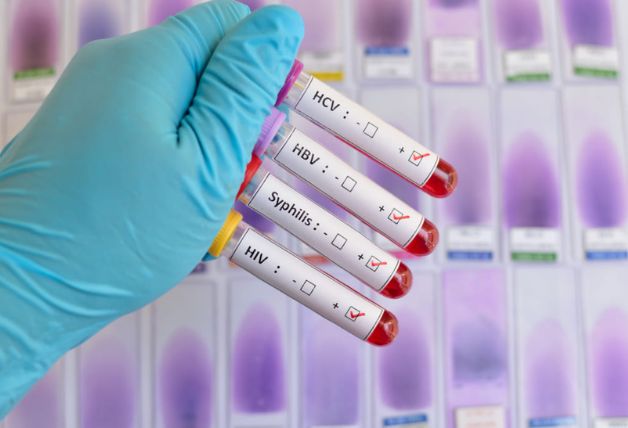 Không có triệu chứng có cần xét nghiệm bệnh lây truyền qua đường tình dục không