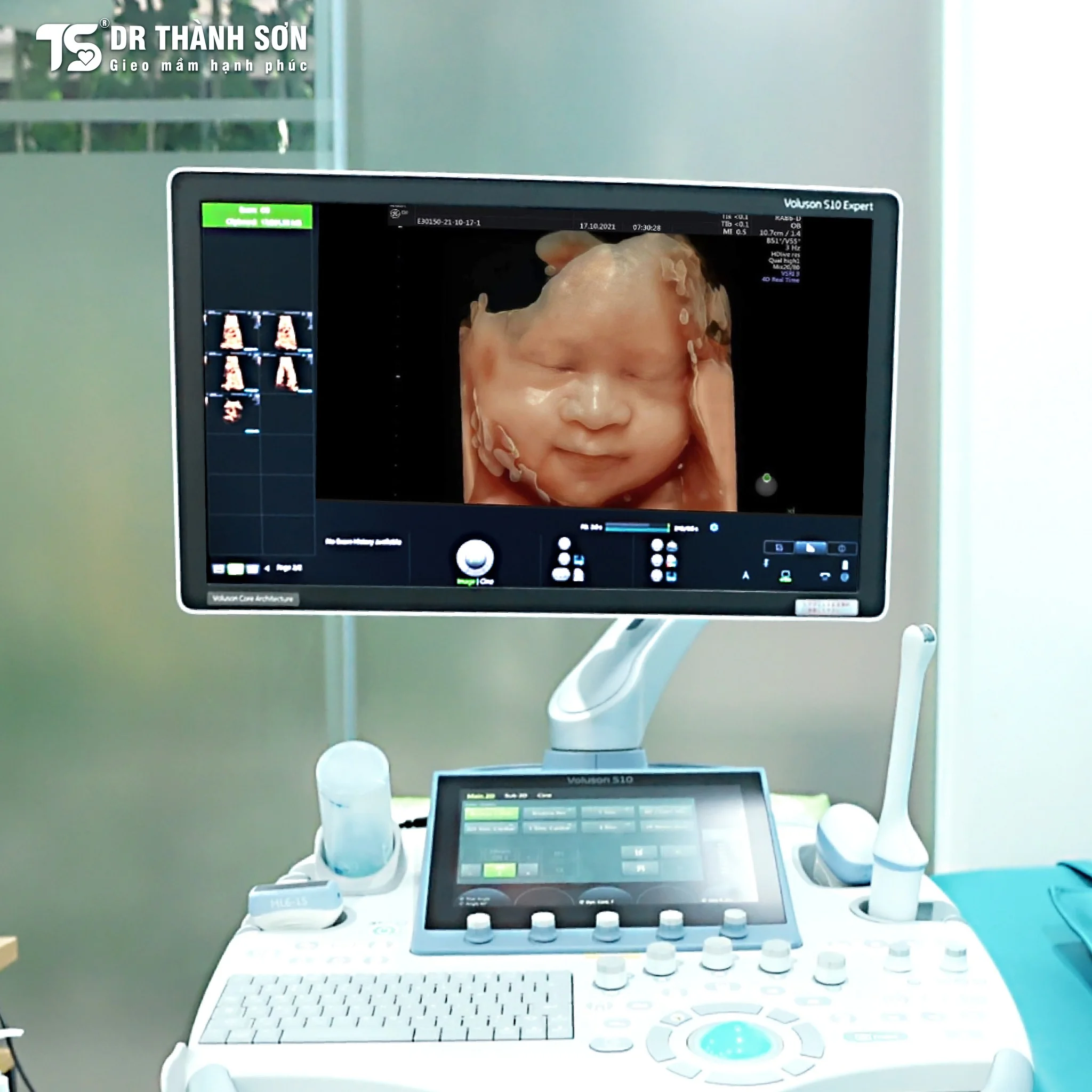 Chi phí khám thai hiện nay là bao nhiêu Có đắt không