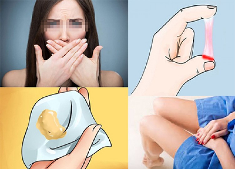 7 dấu hiệu khí hư bất thường chị em không nên chủ quan