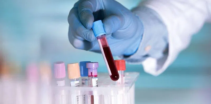 Chi phí xét nghiệm double test, triple test và NIPT bao nhiêu tiền?