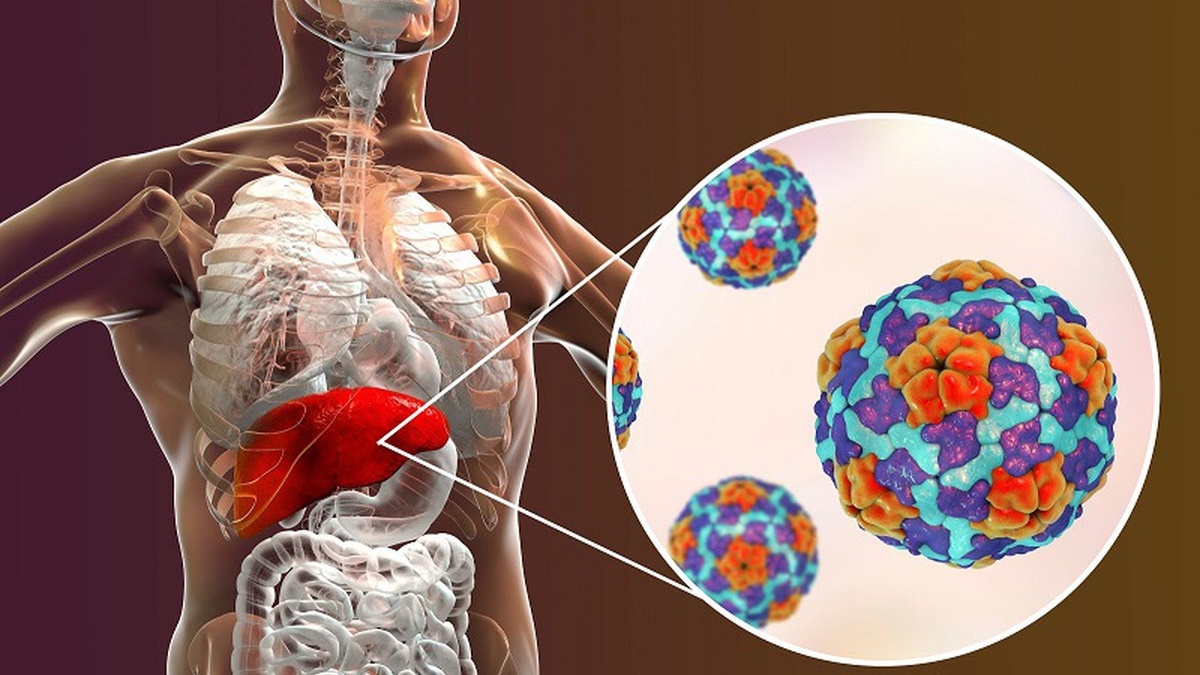 Viêm gan C có lây qua quan hệ tình dục